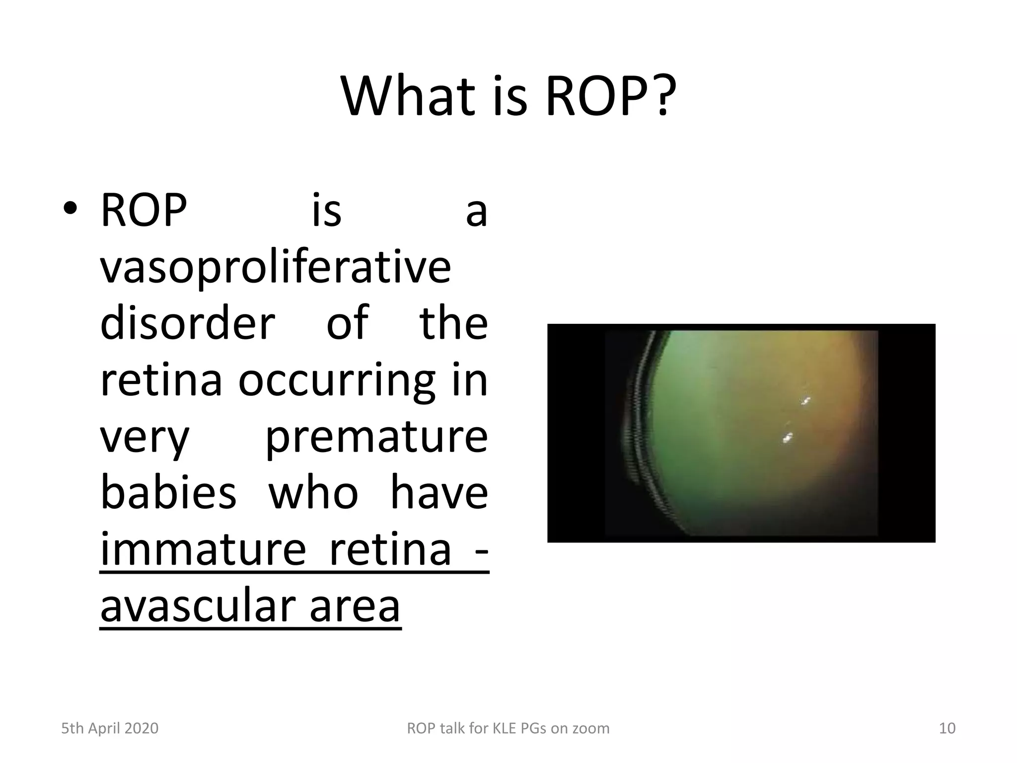 DR WANI'S TALK ON Retinopathy of prematurity | PPTX