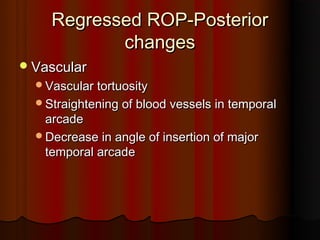 Retinopathy of prematurity (upload for site) | PPT