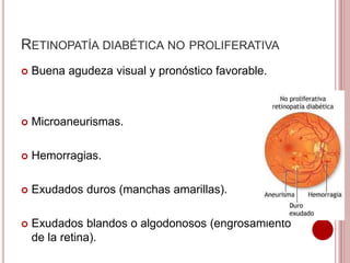 RETINOPATÍA DIABÉTICA NO PROLIFERATIVA 
 Buena agudeza visual y pronóstico favorable. 
 Microaneurismas. 
 Hemorragias. 
 Exudados duros (manchas amarillas). 
 Exudados blandos o algodonosos (engrosamiento 
de la retina). 
 