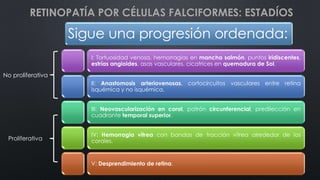 Sigue una progresión ordenada:
I: Tortuosidad venosa, hemorragias en mancha salmón, puntos iridiscentes,
estrías angioides, asas vasculares, cicatrices en quemadura de Sol.
II: Anastomosis arteriovenosas, cortocircuitos vasculares entre retina
isquémica y no isquémica.
III: Neovascularización en coral, patrón circunferencial, predilección en
cuadrante temporal superior.
IV: Hemorragia vítrea con bandas de tracción vítrea alrededor de los
corales.
V: Desprendimiento de retina.
RETINOPATÍA POR CÉLULAS FALCIFORMES: ESTADÍOS
No proliferativa
Proliferativa
 