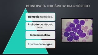 Biometría hemática.
Aspirado de Médula
ósea.
Inmunofenotipo.
Estudios de imagen.
RETINOPATÍA LEUCÉMICA: DIAGNÓSTICO
 