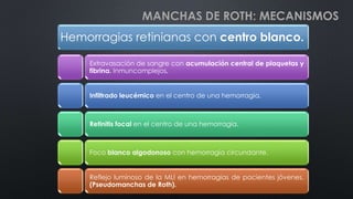 MANCHAS DE ROTH: MECANISMOS
Hemorragias retinianas con centro blanco.
Extravasación de sangre con acumulación central de plaquetas y
fibrina. Inmuncomplejos.
Infiltrado leucémico en el centro de una hemorragia.
Retinitis focal en el centro de una hemorragia.
Foco blanco algodonoso con hemorragia circundante.
Reflejo luminoso de la MLI en hemorragias de pacientes jóvenes.
(Pseudomanchas de Roth).
 