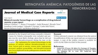 RETINOPATÍA ANÉMICA: PATOGÉNESIS DE LAS
HEMORRAGIAS
 