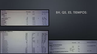 BH, QS, ES, TIEMPOS:
 