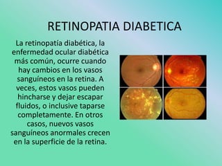 RETINOPATIA DIABETICA
 La retinopatía diabética, la
enfermedad ocular diabética
 más común, ocurre cuando
   hay cambios en los vasos
  sanguíneos en la retina. A
  veces, estos vasos pueden
   hincharse y dejar escapar
  fluidos, o inclusive taparse
   completamente. En otros
      casos, nuevos vasos
sanguíneos anormales crecen
 en la superficie de la retina.
 