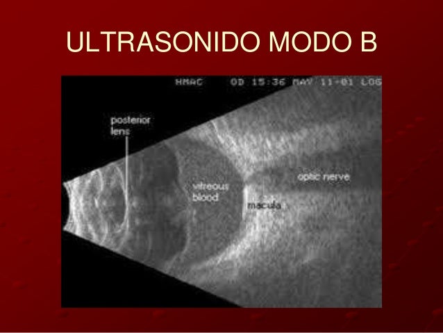 OFTALMOLOGIA: OFTALMOLOGIA:
