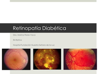Retinopatía Diabética
Dra. Marina Flores Vaca
R4 Retina
Hospital Fundación Nuestra Señora de la Luz
 