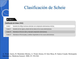 Scheie Classification System Retinopatía Hipertensiva.ppt