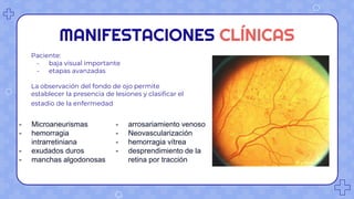 RETINOPATIAS DIABETICA Y HIPERTENSIVA.pptx