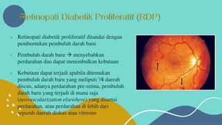 Retinopati diabetik