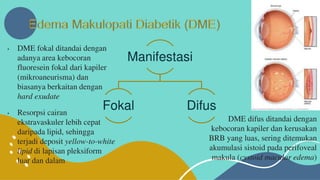 Retinopati diabetik