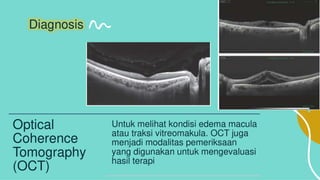 Retinopati diabetik