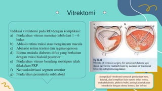 Retinopati diabetik