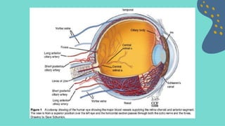 Retinopati diabetik