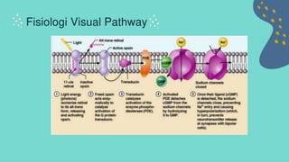 Retinopati diabetik
