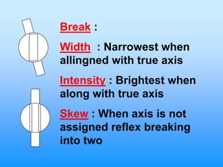 Break :
Width : Narrowest when
allingned with true axis
Intensity : Brightest when
along with true axis
Skew : When axis is not
assigned reflex breaking
into two
 