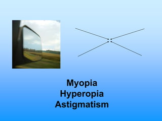 Myopia
 Hyperopia
Astigmatism
 