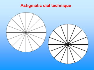 Astigmatic dial technique
 