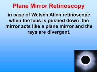 Plane Mirror Retinoscopy
 in case of Welsch Allen retinoscope
  when the lens is pushed down the
mirror acts like a plane mirror and the
          rays are divergent.
 