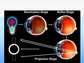 Illumination Stage         Reflex Stage




        Projection Stage
 