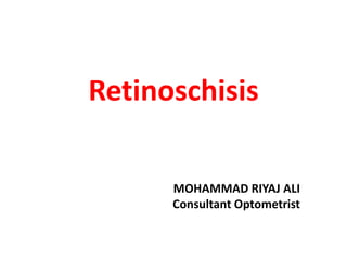 Retinoschisis
MOHAMMAD RIYAJ ALI
Consultant Optometrist
 