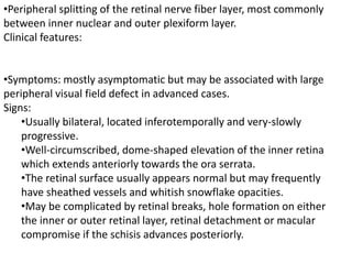 Retinal Splitting Retinoschisis | PPTX