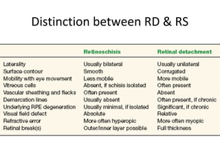 Retinoschisis | PPT