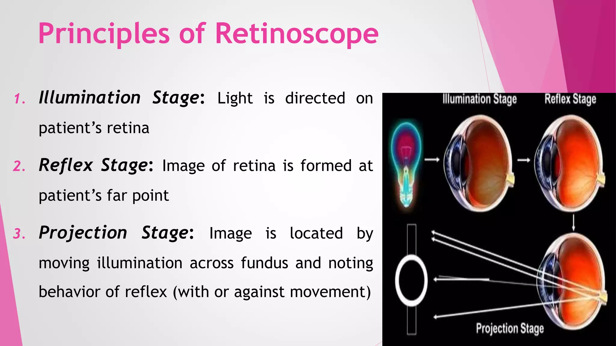 Optics of Retinoscope by Dr. Muhammad Zeeshan Hameed.pptx | Eye and ...