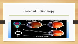 Normal Retinoscopy Retinoscope: Principle, types, Technique, and Clinical Applications | PPTX