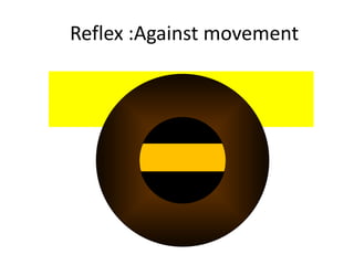 Reflex :Against movement
 