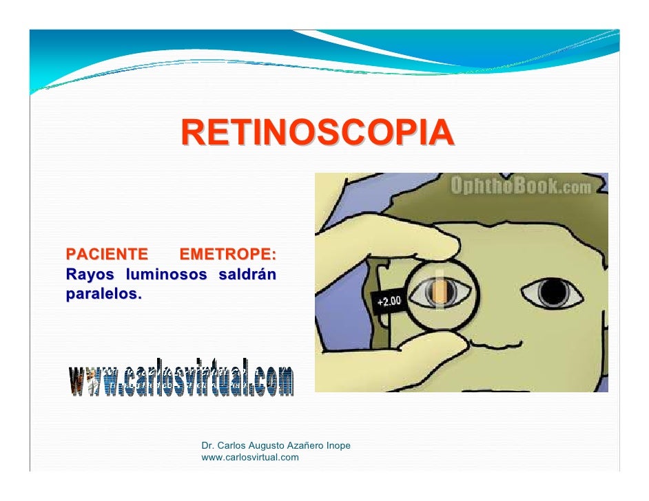Retinoscopia