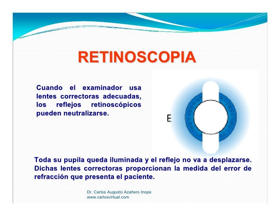 Retinoscopia