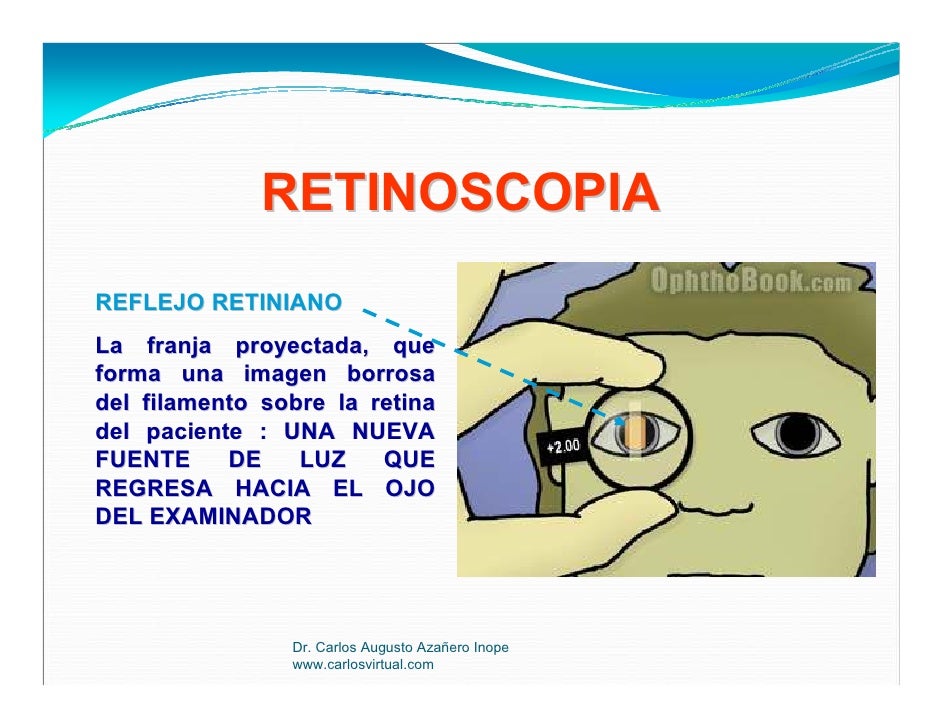 Retinoscopia
