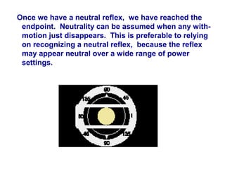 Once we have a neutral reflex, we have reached the
endpoint. Neutrality can be assumed when any with-
motion just disappears. This is preferable to relying
on recognizing a neutral reflex, because the reflex
may appear neutral over a wide range of power
settings.
 