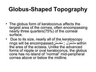 Globus-Shaped Topography
• The globus form of keratoconus affects the
largest area of the cornea, often encompassing
nearly three quarters(75%) of the corneal
surface.
• Due to its size, nearly all of the keratoscopy
rings will be encompassed‫ ن‬w‫م‬َّ‫ا‬ ‫ض‬َ‫ْك‬ ‫م‬ُ‫س‬ ; ‫ملول‬ُ‫س‬ ‫ش‬ْ‫ِش‬ ‫م‬َ‫ْك‬ within
the area of the ectasia. Unlike the advanced
forms of nipple or oval keratoconus, the globus
cone has no island of “normal” mid-peripheral
cornea above or below the midline.
 