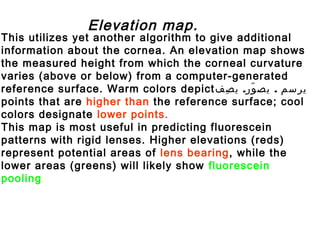 This utilizes yet another algorithm to give additional
information about the cornea. An elevation map shows
the measured height from which the corneal curvature
varies (above or below) from a computer-generated
reference surface. Warm colors depict . .‫صف‬ِ ‫ي‬ ‫ور‬ّ ‫يص‬ ‫يرسم‬
points that are higher than the reference surface; cool
colors designate lower points.
This map is most useful in predicting fluorescein
patterns with rigid lenses. Higher elevations (reds)
represent potential areas of lens bearing, while the
lower areas (greens) will likely show fluorescein
pooling.
Elevation map.
 