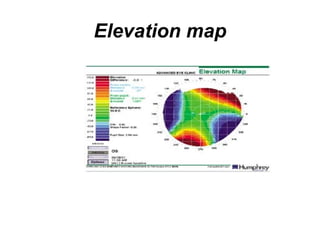 Elevation map
 