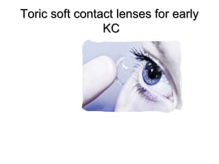 Toric soft contact lenses for earlyToric soft contact lenses for early
KCKC
 