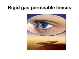 Rigid gas permeable lensesRigid gas permeable lenses
 