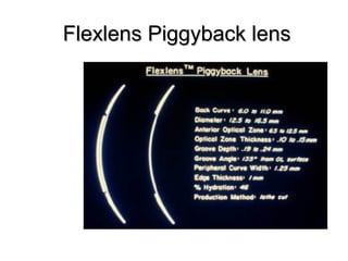 Flexlens Piggyback lensFlexlens Piggyback lens
 