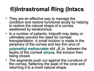 Intrastromal Ring (IntacsIntrastromal Ring (Intacs®(®(
• They are an effective way to manage theThey are an effective way to manage the
condition and restore functional acuity by helpingcondition and restore functional acuity by helping
to restore the natural shape of a corneato restore the natural shape of a cornea
weakened by keratoconus.weakened by keratoconus.
• In a number of patients, Intacs® may delay orIn a number of patients, Intacs® may delay or
ultimately prevent the need for cornealultimately prevent the need for corneal
transplantation. A small incision is made in thetransplantation. A small incision is made in the
periphery of the cornea and two thin arcs ofperiphery of the cornea and two thin arcs of
polymethyl methacrylatepolymethyl methacrylate slidslid ‫يفنزلق‬‫يفنزلق‬ between thebetween the
layers of the corneallayers of the corneal stromastroma, the incision then, the incision then
being closed.being closed.
• The segments push out against the curvature ofThe segments push out against the curvature of
the cornea, flattening the peak of the cone andthe cornea, flattening the peak of the cone and
returning it to a more natural shape.returning it to a more natural shape.
 