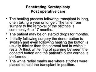 Penetrating KeratoplastyPenetrating Keratoplasty
Post operative carePost operative care
• The healing process following transplant is long,The healing process following transplant is long,
often taking a year or longer. The time fromoften taking a year or longer. The time from
surgery to the removal of the stitches issurgery to the removal of the stitches is
commonly 6 to 17 months.commonly 6 to 17 months.
• The patient may be on steroid drops for months.The patient may be on steroid drops for months.
• Initially following surgery the donor button isInitially following surgery the donor button is
swollen and even following healing the button isswollen and even following healing the button is
usually thicker than the corneal bed in which itusually thicker than the corneal bed in which it
rests. A thick white ring of scarring between therests. A thick white ring of scarring between the
donated button and the patient's outer cornea isdonated button and the patient's outer cornea is
performed.performed.
• The white radial marks are where stitches wereThe white radial marks are where stitches were
placed to hold the transplant in position.placed to hold the transplant in position.
 