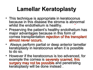 Lamellar KeratoplastyLamellar Keratoplasty
• This technique is appropriate in keratoconusThis technique is appropriate in keratoconus
because in this disease the stroma is abnormalbecause in this disease the stroma is abnormal
whilst the endothelium is healthy.whilst the endothelium is healthy.
• Preserving the patient’s healthy endothelium hasPreserving the patient’s healthy endothelium has
major advantages because in this form ofmajor advantages because in this form of
cornea transplantationcornea transplantation rejection of the transplantrejection of the transplant
almost never occurs.almost never occurs.
• Always perform partial or deep anterior lamellarAlways perform partial or deep anterior lamellar
keratoplasty in keratoconus when it is possiblekeratoplasty in keratoconus when it is possible
to do so.to do so.
• However if the keratoconus is too advanced, forHowever if the keratoconus is too advanced, for
example the cornea isexample the cornea is severely scarred, thisseverely scarred, this
surgery may not be possiblesurgery may not be possible and penetratingand penetrating
keratoplasty will be done insteadkeratoplasty will be done instead .
 