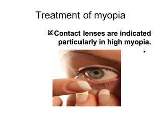 Treatment of myopia
Contact lenses are indicatedContact lenses are indicated
particularly in high myopia.particularly in high myopia.
•
 
