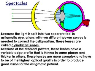 Because the light is split into two separate foci in
astigmatic eye, a lens with two different power curves is
needed to correct the astigmatism. These lenses are
called cylindrical Lenses.
Because of the different powers, these lenses have a
variable edge profile that is thinner in some places and
thicker in others. These lenses are more complex and have
to be of the highest optical quality in order to produce
good vision for the astigmatic patient..
Spectacles
 