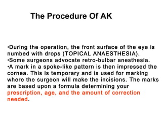 •During the operation, the front surface of the eye is
numbed with drops (TOPICAL ANAESTHESIA).
•Some surgeons advocate retro-bulbar anesthesia.
•A mark in a spoke-like pattern is then impressed the
cornea. This is temporary and is used for marking
where the surgeon will make the incisions. The marks
are based upon a formula determining your
prescription, age, and the amount of correction
needed.
The Procedure Of AK
 