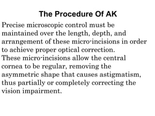 Precise microscopic control must be
maintained over the length, depth, and
arrangement of these micro-incisions in order
to achieve proper optical correction.
These micro-incisions allow the central
cornea to be regular, removing the
asymmetric shape that causes astigmatism,
thus partially or completely correcting the
vision impairment.
The Procedure Of AK
 