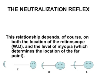 THE NEUTRALIZATION REFLEX
This relationship depends, of course, on
both the location of the retinoscope
(W.D), and the level of myopia (which
determines the location of the far
point).
C
 