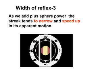 As we add plus sphere power the
streak tends to narrow and speed up
in its apparent motion.
3-Width of reflex
 