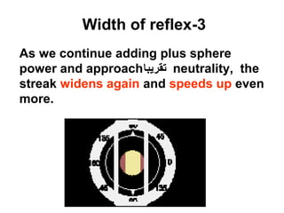As we continue adding plus sphere
power and approach‫تقريبا‬ neutrality, the
streak widens again and speeds up even
more.
3-Width of reflex
 